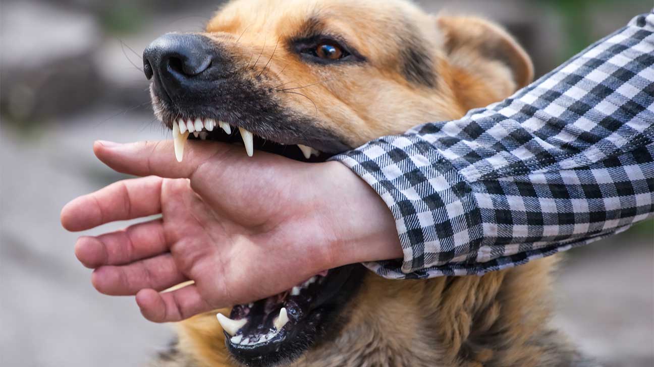 dog-bite-injury-attorneys