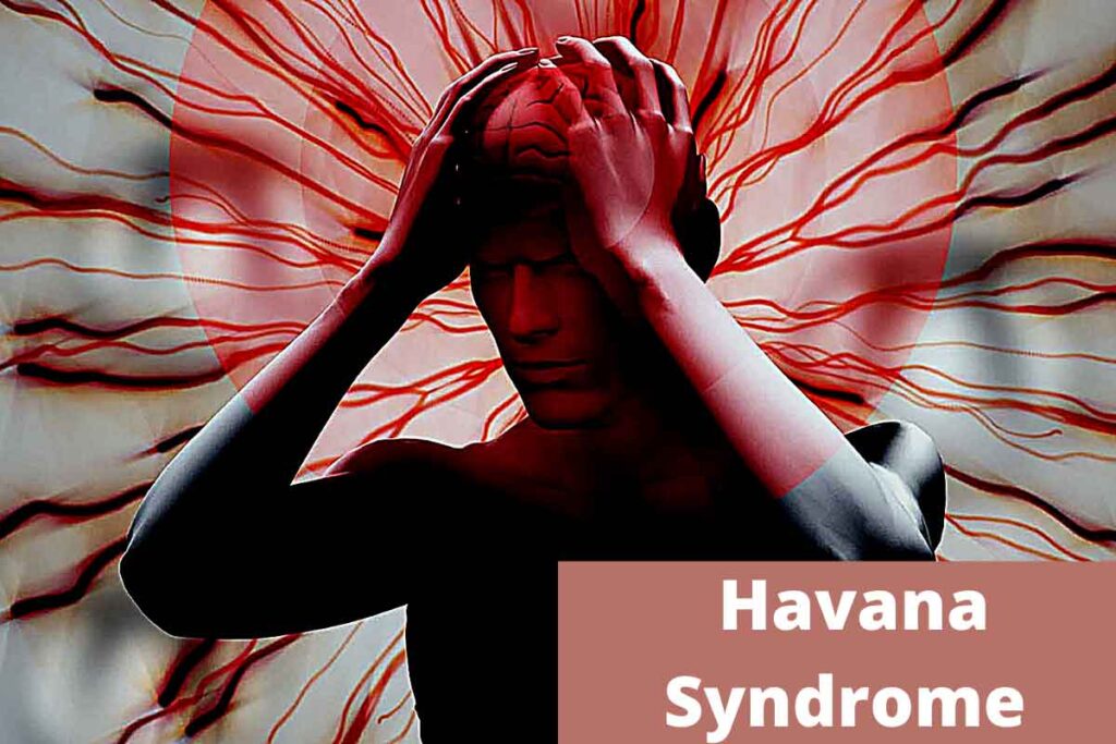 Havana-Syndrome